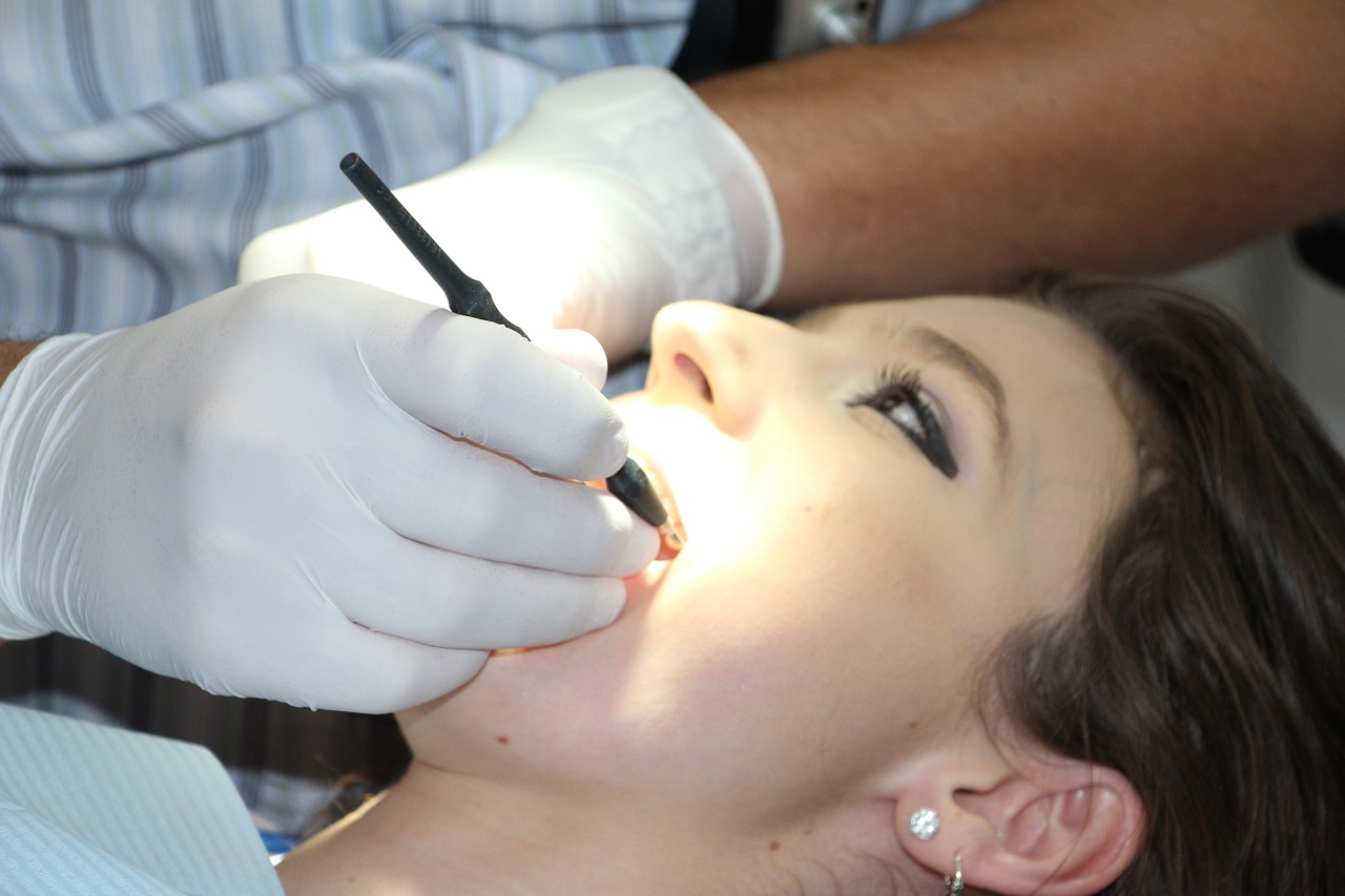 Dlaczego warto regularnie sprawdzać stan zębów?